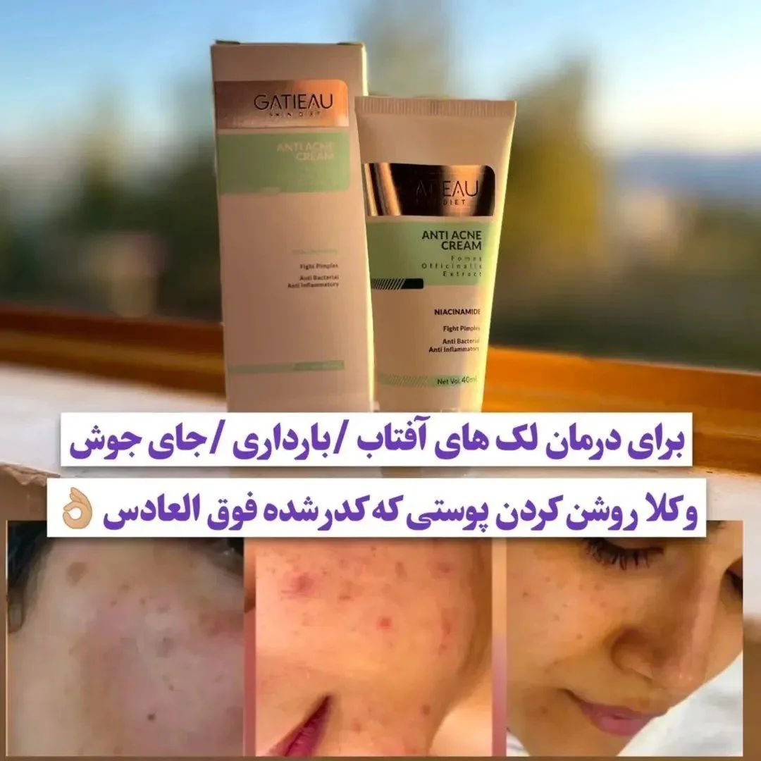 🛡️ کرم ضد آفتاب گاتیو: محافظت بی‌نقص، پوستی بینقص! ✨  ✨با کرم ضد آفتاب گاتیو، هر روز پوستت رو در برابر آفتاب، آلودگی و پیری زودرس بیمه کن! این ضد آفتاب حرفه‌ای، ترکیبی از محافظت بالا + آبرسانی + ترمیم هست که پوستت رو مثل روز اول شاداب و جوان نگه میداره